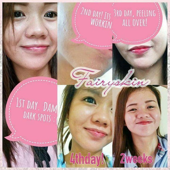 Fairy Skin Derma Facial Set Rejuvenating Whitening - Picture 5 of 8